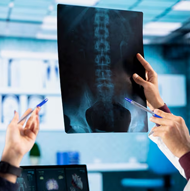 X-Ray